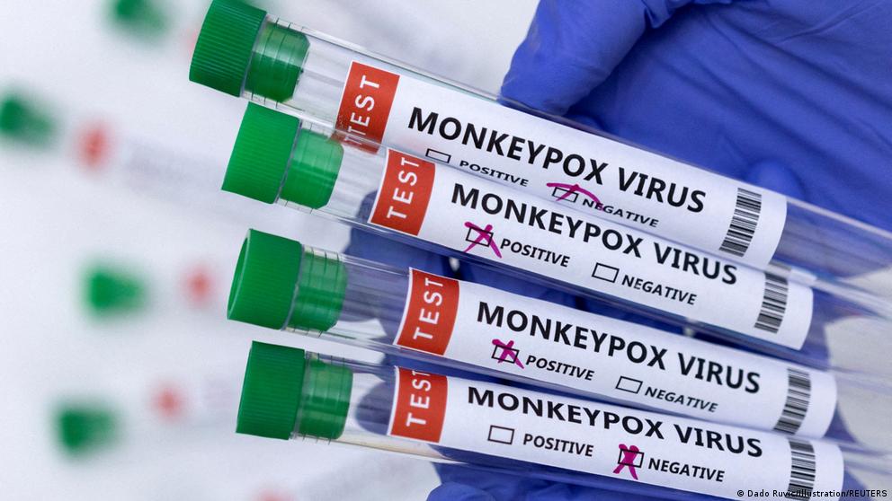 image for OMS descarta por ahora una pandemia por viruela del mono