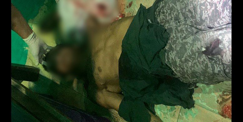 Jovem é executado com oito tiros image for Jovem é executado com oito tiros