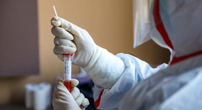 image for Goiás supera 20 mil casos confirmados de covid-19