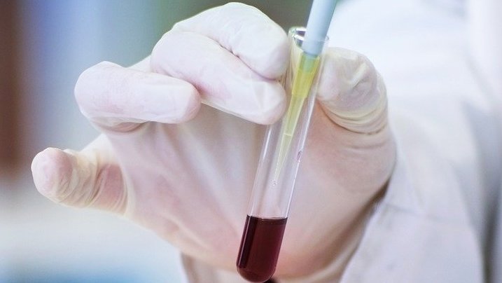 image for China comienza ensayos en humanos de posibles vacunas contra el coronavirus