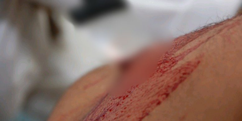 Jovem foi assassinado a facadas em um bloco de carnaval image for Jovem foi assassinado a facadas em um bloco de carnaval