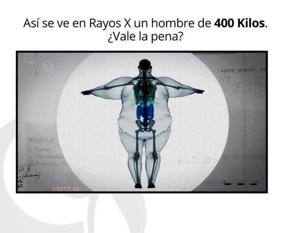 image for Obesidad en Colombia / Sus riesgos y cómo evitarla