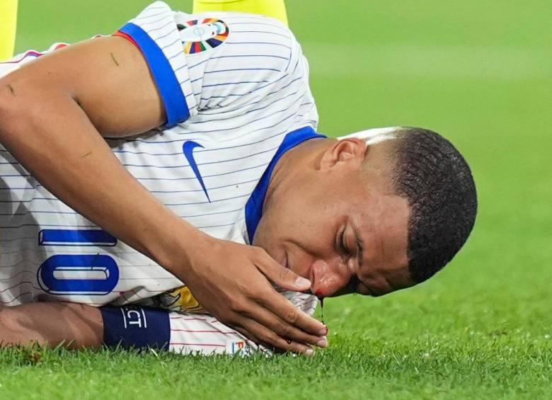 image for Kylian Mbappé usará una máscara en la Eurocopa 2024