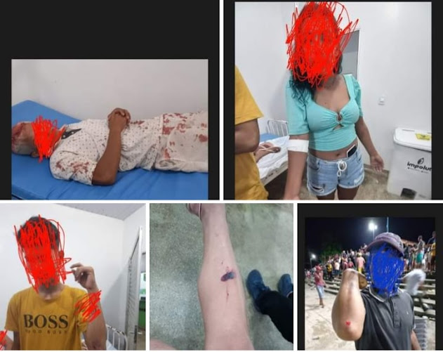 Cerca de 30 pessoas ficam feridas após confusão entre PM e a população na festa do aniversário de Atalaia do Norte (AM) Cerca de 30 pessoas ficam feridas após confusão entre PM e a população na festa do aniversário de Atalaia do Norte (AM)