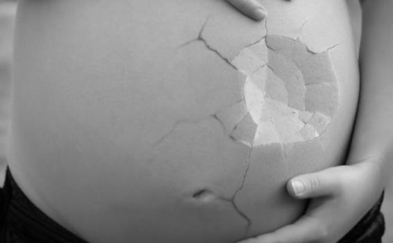 image for Protestas en Alabama en contra de estricta ley que penaliza el aborto