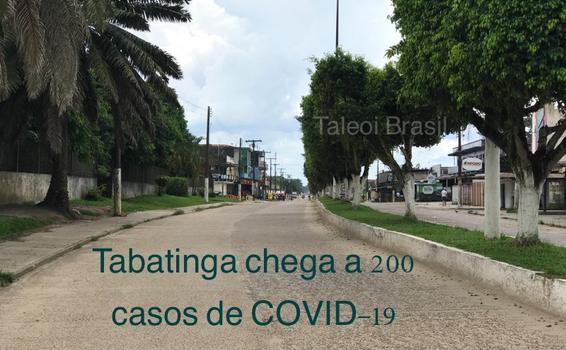 Tabatinga chega a 211 casos de COVID-19 image for Tabatinga chega a 211 casos de COVID-19