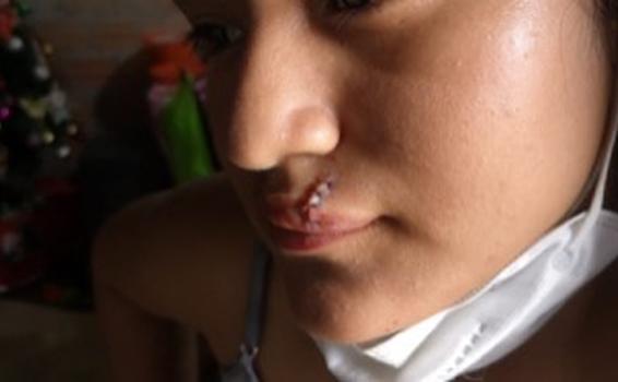 Chofer de colectivo rompe labio a su exmujer de un puñetazo image for Chofer de colectivo rompe labio a su exmujer de un puñetazo
