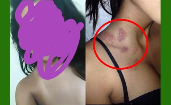 Mulher aparece toda chupada e diz a delegado ter sido atacada por Morcegão image for Mulher aparece toda chupada e diz a delegado ter sido atacada por Morcegão