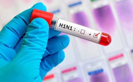 Amazonas tem 72 casos e 21 mortes por H1N1 Tubo de ensayo