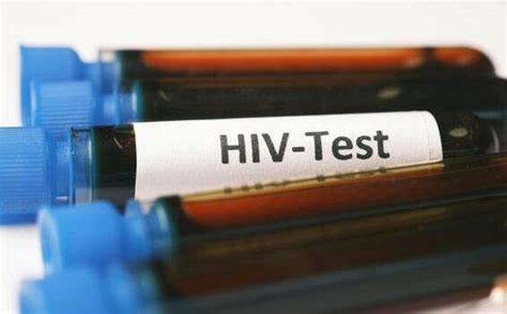 Ministerio da saude orienta farmacias sobre testes para HIV image for Ministerio da saude orienta farmacias sobre testes para HIV