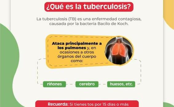 La tuberculosis  es una enfermedad causada por el Bacilo de Koch 