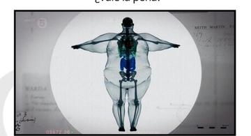 image for Obesidad en Colombia / Sus riesgos y cómo evitarla
