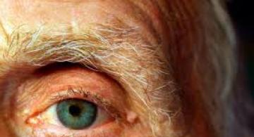 Anciano mostrando un solo ojo